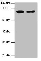 Western blot All lanes: LSS antibody at 0.76µg/ml Lane 1: PC-3 whole cell lysate Lane 2: Hela whole cell lysate Secondary Goat polyclonal to Rabbit IgG at 1/10000 dilution Predicted band size: 84, 75, 83 kDa Observed band size: 83 kDa