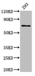 Western Blot Positive WB detected in: 293 whole cell lysate All lanes: LTA4H antibody at 3ug/ml Secondary Goat polyclonal to rabbit IgG at 1/50000 dilution Predicted band size: 70, 60, 58, 67 kDa Observed band size: 70 kDa