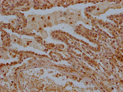 IHC image of CSB-PA013228OA01HU diluted at 1:300 and staining in paraffin-embedded human lung tissue performed on a Leica BondTM system. After dewaxing and hydration, antigen retrieval was mediated by high pressure in a citrate buffer (pH 6.0). Se...