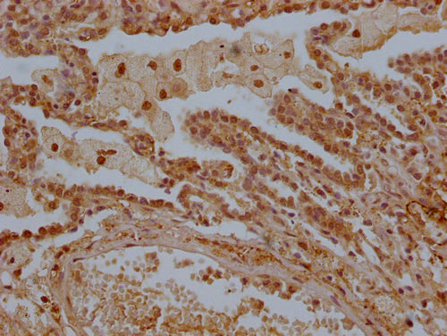 IHC image of CSB-PA013228OA01HU diluted at 1:300 and staining in paraffin-embedded human lung tissue performed on a Leica BondTM system. After dewaxing and hydration, antigen retrieval was mediated by high pressure in a citrate buffer (pH 6.0). Se...
