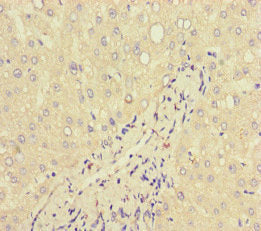 Immunohistochemistry of paraffin-embedded human liver tissue using CSB-PA013229LA01HU at dilution of 1:100