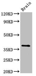 Western Blot Positive WB detected in: Rat brain tissue All lanes: Lum antibody at 2.5µg/ml Secondary Goat polyclonal to rabbit IgG at 1/50000 dilution Predicted band size: 39 kDa Observed band size: 39 kDa