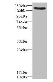 Western blot All lanes: LY75 antibody IgG at 1.57ug/ml + Mouse liver tissue Secondary Goat polyclonal to rabbit IgG at 1/10000 dilution Predicted band size: 199, 216, 20, 210 kDa Observed band size: 199 kDa
