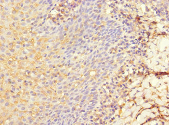 Immunohistochemistry of paraffin-embedded human tonsil tissue using CSB-PA013251ESR2HU at dilution of 1:100
