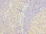Immunohistochemistry of paraffin-embedded human tonsil tissue using CSB-PA013252ESR1HU at dilution of 1:100