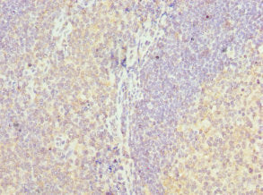 Immunohistochemistry of paraffin-embedded human tonsil tissue using CSB-PA013252ESR1HU at dilution of 1:100