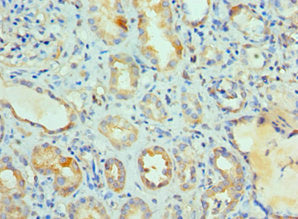 Immunohistochemistry of paraffin-embedded human kidney tissue using CSB-PA013254ESR1HU at dilution of 1:100