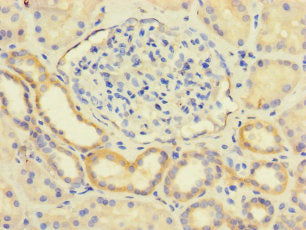 Immunohistochemistry of paraffin-embedded human kidney tissue using CSB-PA013254LA01HU at dilution of 1:100