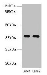 Western blot All lanes: LYPD3 antibody at 4µg/ml Lane 1: MCF-7 whole cell lysate Lane 2: Mouse stomach tissue Secondary Goat polyclonal to rabbit IgG at 1/10000 dilution Predicted band size: 36 kDa Observed band size: 36 kDa