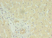 Immunohistochemistry of paraffin-embedded human liver tissue using CSB-PA013272LA01HU at dilution of 1:100