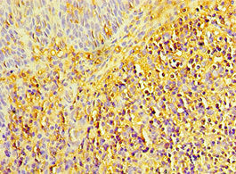 Immunohistochemistry of paraffin-embedded human tonsil tissue using CSB-PA013283DSR1HU at dilution of 1:100