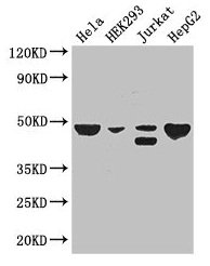 Western Blot Positive WB detected in: Hela whole cell lysate, HEK293 whole cell lysate, Jurkat whole cell lysate, HepG2 whole cell lysate All lanes: PLIN3 antibody at 3µg/ml Secondary Goat polyclonal to rabbit IgG at 1/50000 dilution Predicted ban...