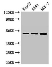 Western Blot Positive WB detected in: HepG2 whole cell lysate, A549 whole cell lysate, MCF-7 whole cell lysate All lanes: MAEA antibody at 3µg/ml Secondary Goat polyclonal to rabbit IgG at 1/50000 dilution Predicted band size: 46, 41, 37, 27 kDa O...