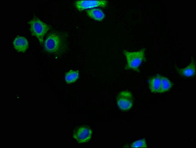 Immunofluorescence staining of MCF-7 cells with CSB-PA013322LA01HU at 1:200, counter-stained with DAPI. The cells were fixed in 4% formaldehyde, permeabilized using 0.2% Triton X-100 and blocked in 10% normal Goat Serum. The cells were then incuba...