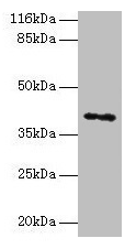 Western blot All lanes: MAGEA10 antibody at 2µg/ml + HL60 whole cell lysate Secondary Goat polyclonal to rabbit IgG at 1/10000 dilution Predicted band size: 41 kDa Observed band size: 41 kDa
