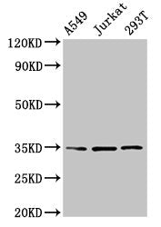 Western Blot Positive WB detected in: A549 whole cell lysate, Jurkat whole cell lysate, 293T whole cell lysate All lanes: MAGEA3 antibody at 4µg/ml Secondary Goat polyclonal to rabbit IgG at 1/50000 dilution Predicted band size: 35 kDa Observed ba...
