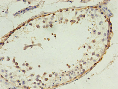 Immunohistochemistry of paraffin-embedded human testis tissue using CSB-PA013330LA01HU at dilution of 1:100