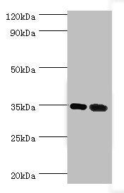 Western blot All lanes: MAGEA6 antibody at 7ug/ml Lane 1: Rat brain tissue Lane 2: Rat gonad tissue Secondary Goat polyclonal to rabbit IgG at 1/10000 dilution Predicted band size: 35 kDa Observed band size: 35 kDa