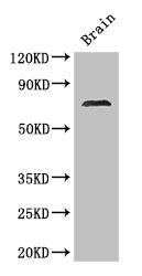 Western Blot Positive WB detected in: Mouse brain tissue All lanes: MAK antibody at 2.8ug/ml Secondary Goat polyclonal to rabbit IgG at 1/50000 dilution Predicted band size: 71, 74, 67 kDa Observed band size: 71 kDa