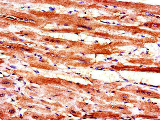 Immunohistochemistry of paraffin-embedded human heart tissue using CSB-PA013372LA01HU at dilution of 1:100