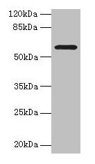 Western blot All lanes: MAOA antibody at 1µg/ml + HepG2 whole cell lysate Secondary Goat polyclonal to rabbit IgG at 1/10000 dilution Predicted band size: 60, 45 kDa Observed band size: 60 kDa