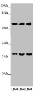 Western blot All lanes: MAOB antibody at 9µg/ml Lane 1: Mouse liver tissue Lane 2: HepG2 whole cell lysate Lane 3: A549 whole cell lysate Secondary Goat polyclonal to rabbit IgG at 1/10000 dilution Predicted band size: 59, 47 kDa Observed band siz...