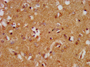 IHC image of CSB-PA013400LA01HU diluted at 1:400 and staining in paraffin-embedded human brain tissue performed on a Leica BondTM system. After dewaxing and hydration, antigen retrieval was mediated by high pressure in a citrate buffer (pH 6.0). S...