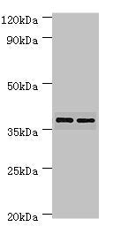 Western blot All lanes: MAP2K3 antibody at 7ug/ml Lane 1: MCF-7 whole cell lysate Lane 2: COLO320 whole cell lysate Secondary Goat polyclonal to rabbit IgG at 1/10000 dilution Predicted band size: 40, 37 kDa Observed band size: 40 kDa