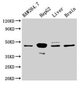 Western Blot Positive WB detected in: RAW264.7 whole cell lysate, HepG2 whole cell lysate, Rat liver tissue, Mouse brain tissue All lanes: Map2k4 antibody at 3.2µg/ml Secondary Goat polyclonal to rabbit IgG at 1/50000 dilution Predicted band size:...