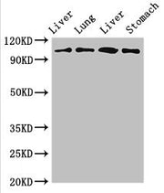 Western Blot Positive WB detected in: Rat liver tissue, Rat lung tissue, Mouse liver tissue, Mouse stomach tissue All lanes: MAP3K13 antibody at 3ug/ml Secondary Goat polyclonal to rabbit IgG at 1/50000 dilution Predicted band size: 109, 18, 93, 8...
