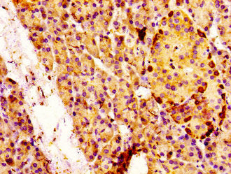 IHC image of CSB-PA013426LA01HU diluted at 1:100 and staining in paraffin-embedded human pancreatic tissue performed on a Leica BondTM system. After dewaxing and hydration, antigen retrieval was mediated by high pressure in a citrate buffer (pH 6....
