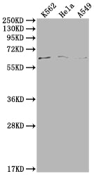 Western Blot Positive WB detected in: K562 whole cell lysate, Hela whole cell lysate, A549 whole cell lysate All lanes: MAP3K7 antibody at 1:500 Secondary Goat polyclonal to rabbit IgG at 1/50000 dilution Predicted band size: 68, 65, 57, 54 kDa Ob...