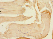 Immunohistochemistry of paraffin-embedded human skeletal muscle tissue using CSB-PA013438ESR1HU at dilution of 1:100