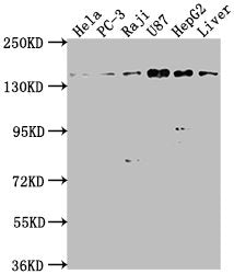 Western Blot Positive WB detected in: Hela whole cell lysate, PC-3 whole cell lysate, Raji whole cell lysate, U87 whole cell lysate, HepG2 whole cell lysate, Mouse liver tissue All lanes: MAP4K4 antibody at 1:1000 Secondary Goat polyclonal to rabb...