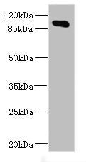 Western blot All lanes: MAP4K5 antibody at 4.2ug/ml + Mouse brain tissue Secondary Goat polyclonal to rabbit IgG at 1/10000 dilution Predicted band size: 95 kDa Observed band size: 95 kDa