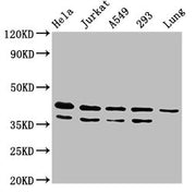 Western Blot Positive WB detected in: Hela whole cell lysate, Jurkat whole cell lysate, A549 whole cell lysate, 293 whole cell lysate, Rat lung tissue All lanes: MAPK1 antibody at 4.8ug/ml Secondary Goat polyclonal to rabbit IgG at 1/50000 dilutio...