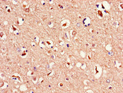 Immunohistochemistry of paraffin-embedded human brain tissue using CSB-PA013449LA01HU at dilution of 1:100