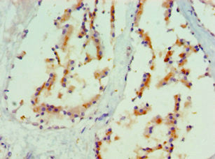 Immunohistochemistry of paraffin-embedded human prostate tissue using CSB-PA013452ESR1HU at dilution of 1:100