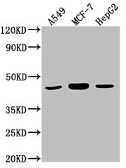 Western Blot Positive WB detected in: A549 whole cell lysate, MCF-7 whole cell lysate, HepG2 whole cell lysate All lanes: MAPK14 antibody at 1:2000 Secondary Goat polyclonal to rabbit IgG at 1/50000 dilution Predicted band size: 42, 35, 36, 30 kDa...