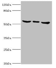 Western blot All lanes: MAPK15 antibody at 6ug/ml Lane 1: Hela whole cell lysate Lane 2: MCF-7 whole cell lysate Lane 3: HepG2 whole cell lysate Secondary Goat polyclonal to rabbit IgG at 1/10000 dilution Predicted band size: 60, 29, 32 kDa Observ...