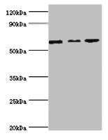 Western blot All lanes: MAPK4 ntibody at 6ug/ml Lane 1: Mouse brain tissue Lane 2: 293T whole cell lysate Lane 3: Jurkat whole cell lysate Secondary Goat polyclonal to rabbit IgG at 1/10000 dilution Predicted band size: 66 kDa Observed band size:...