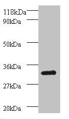 Western blot All lanes: Proteasome subunit beta type-7 antibody at 2ug/ml + 293T whole cell lysate Secondary Goat polyclonal to rabbit IgG at 1/15000 dilution Predicted band size: 30, 16 kDa Observed band size: 30 kDa