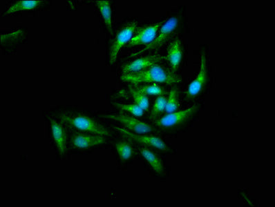 Immunofluorescence staining of Hela cells with CSB-PA013471LA01HU at 1:266, counter-stained with DAPI. The cells were fixed in 4% formaldehyde, permeabilized using 0.2% Triton X-100 and blocked in 10% normal Goat Serum. The cells were then incubat...