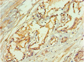 Immunohistochemistry of paraffin-embedded human prostate tissue using CSB-PA013477ESR2HU at dilution of 1:100