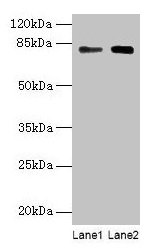 Western blot All lanes: MASP1 antibody at 6µg/ml Lane 1: Hela whole cell lysate Lane 2: U251 whole cell lysate Secondary Goat polyclonal to rabbit IgG at 1/10000 dilution Predicted band size: 80, 82, 44, 69 kDa Observed band size: 80 kDa