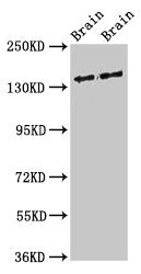 Western Blot Positive WB detected in: Rat brain tissue, Mouse brain tissue All lanes: MAST3 antibody at 3ug/ml Secondary Goat polyclonal to rabbit IgG at 1/50000 dilution Predicted band size: 144 kDa Observed band size: 144 kDa