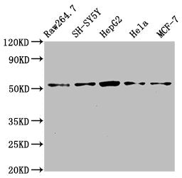 Western Blot Positive WB detected in: RAW264.7 whole cell lysate, SH-SY5Y whole cell lysate, HepG2 whole cell lysate, Hela whole cell lysate, MCF-7 whole cell lysate All lanes: MATN3 antibody at 4ug/ml Secondary Goat polyclonal to rabbit IgG at 1/...