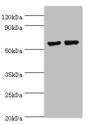Western blot All lanes: MATN3 antibody at 14ug/ml Lane 1: NIH/3T3 whole cell lysate Lane 2: Mouse thymus tissue Secondary Goat polyclonal to rabbit IgG at 1/10000 dilution Predicted band size: 53, 49 kDa Observed band size: 53 kDa