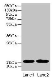 Western blot All lanes: MB antibody at 2µg/ml Lane 1: Rat heart tissue Lane 2: Mouse heart tissue Secondary Goat polyclonal to rabbit IgG at 1/10000 dilution Predicted band size: 18 kDa Observed band size: 18 kDa