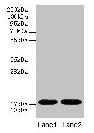 Western blot All lanes: MB antibody at 2µg/ml Lane 1: Rat heart tissue Lane 2: Mouse heart tissue Secondary Goat polyclonal to rabbit IgG at 1/10000 dilution Predicted band size: 18 kDa Observed band size: 18 kDa